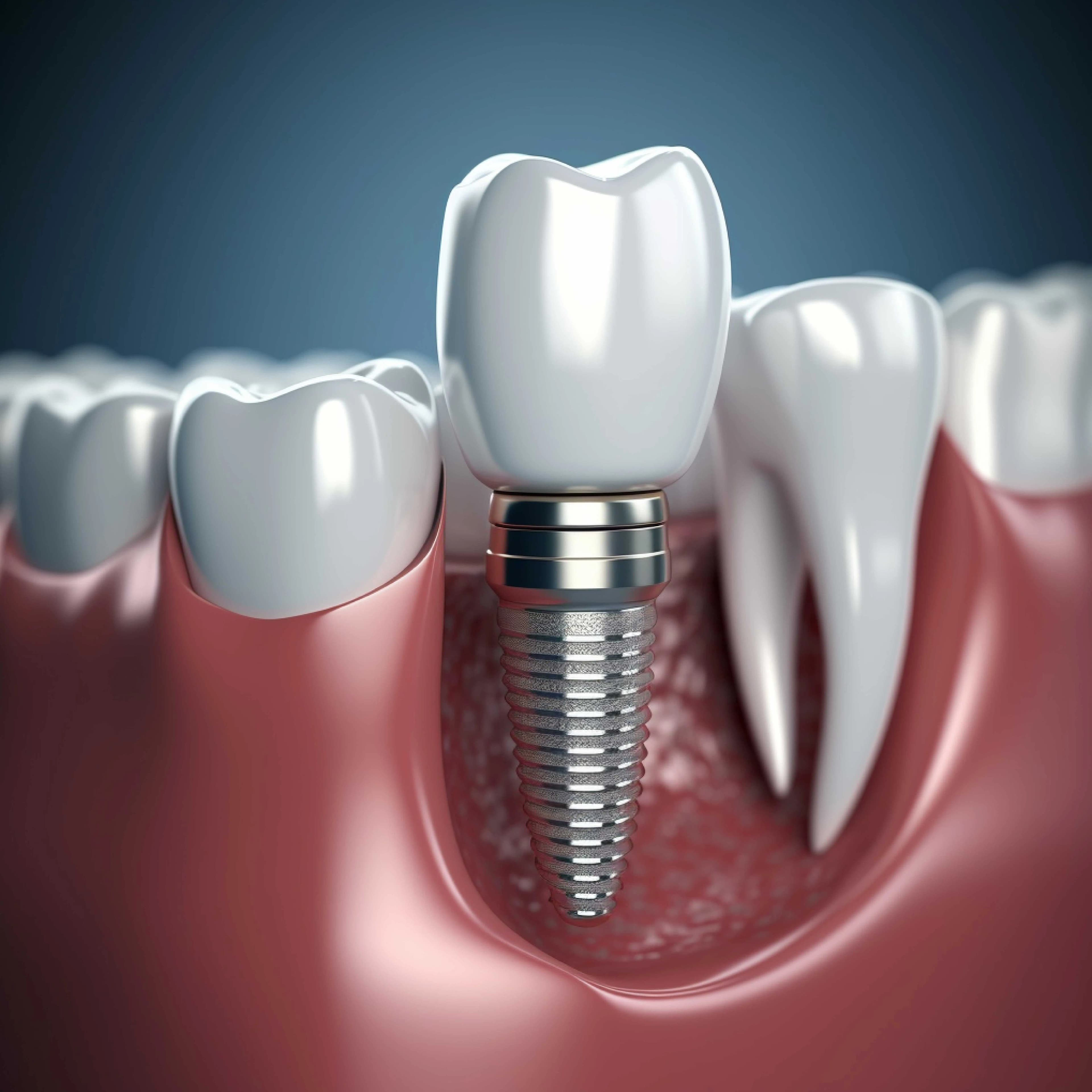 Restorative Dentistry at Dawson Landing Dental in Chestermere