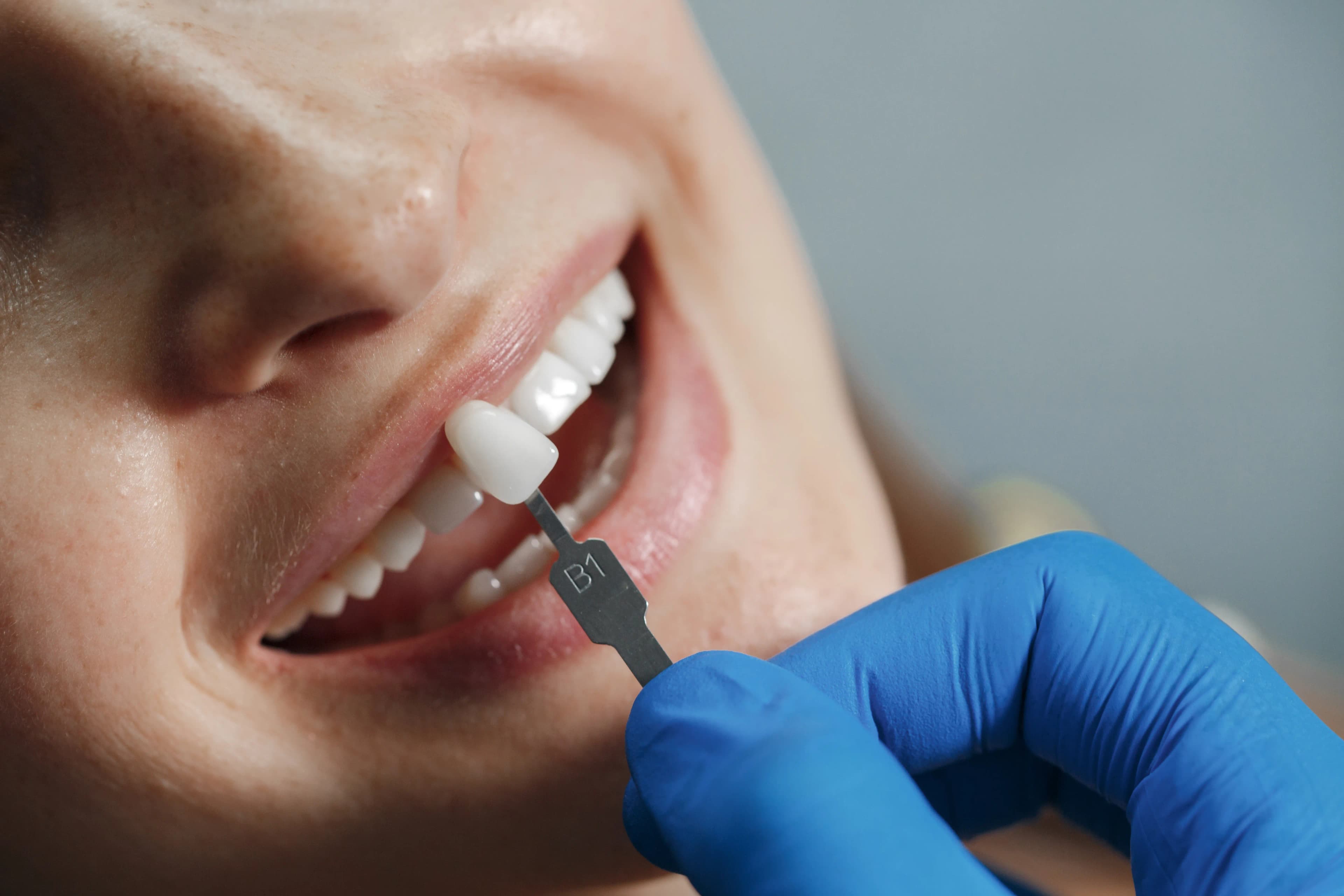 Cosmetic Dentistry at Dawson Landing Dental in Chestermere